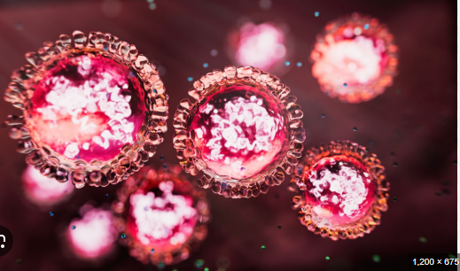Measles Outbreak Texas New update in the US: What You Need to Know measles outbreak texas